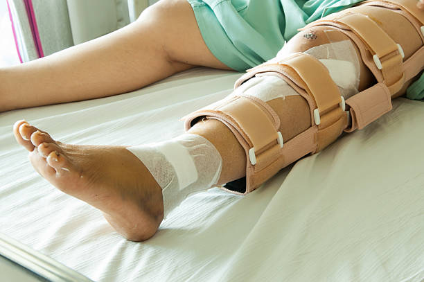 woman wearing a leg brace broken leg picture id506576923